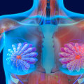 Understanding Hormone Replacement Therapy: Risks and Considerations